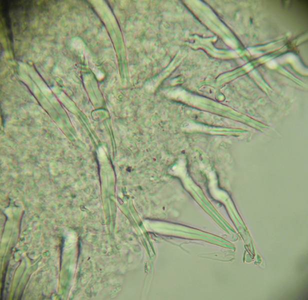 Tubulicrinis? (Tubulicrinis subulatus)